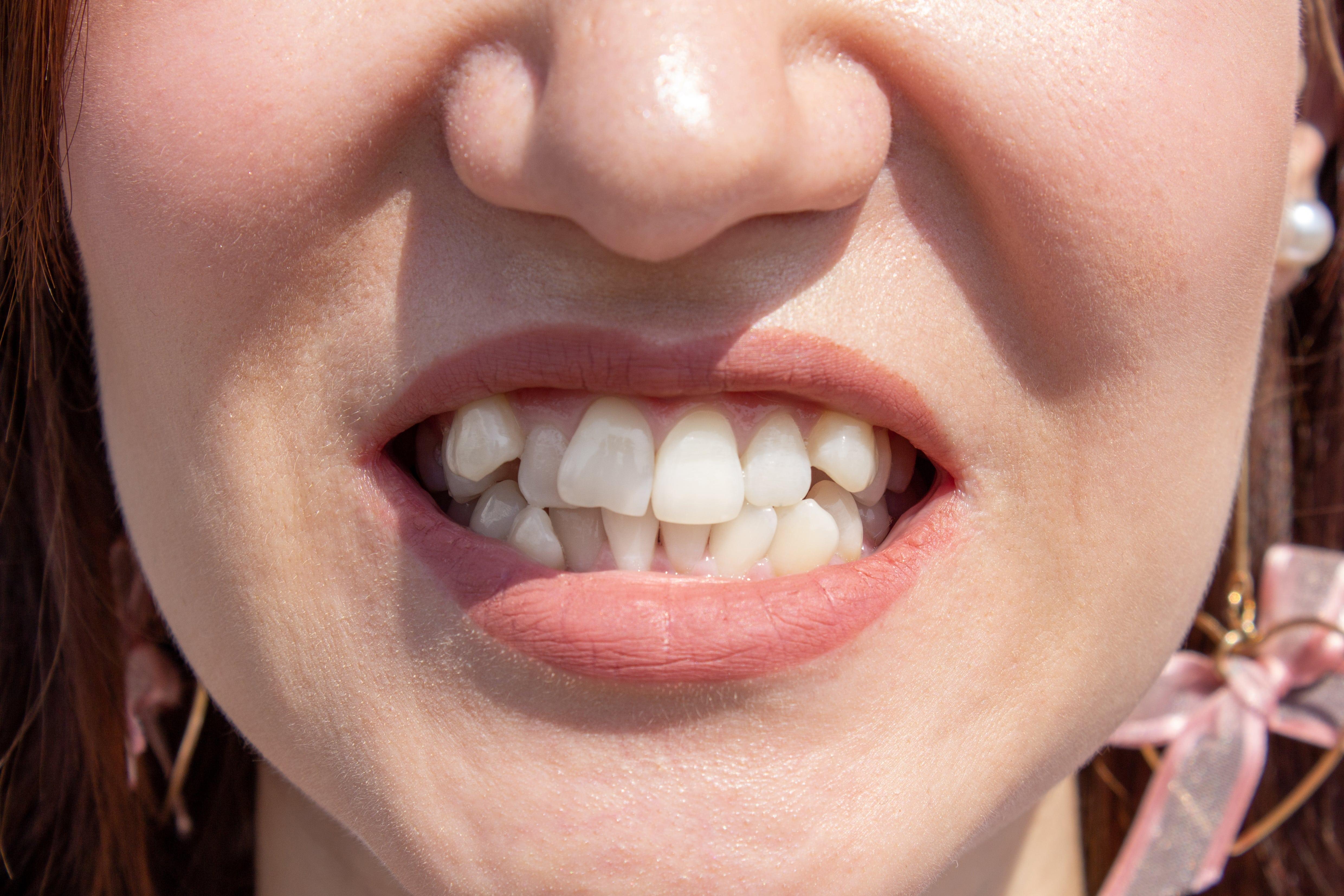 orthodontist Newcastle