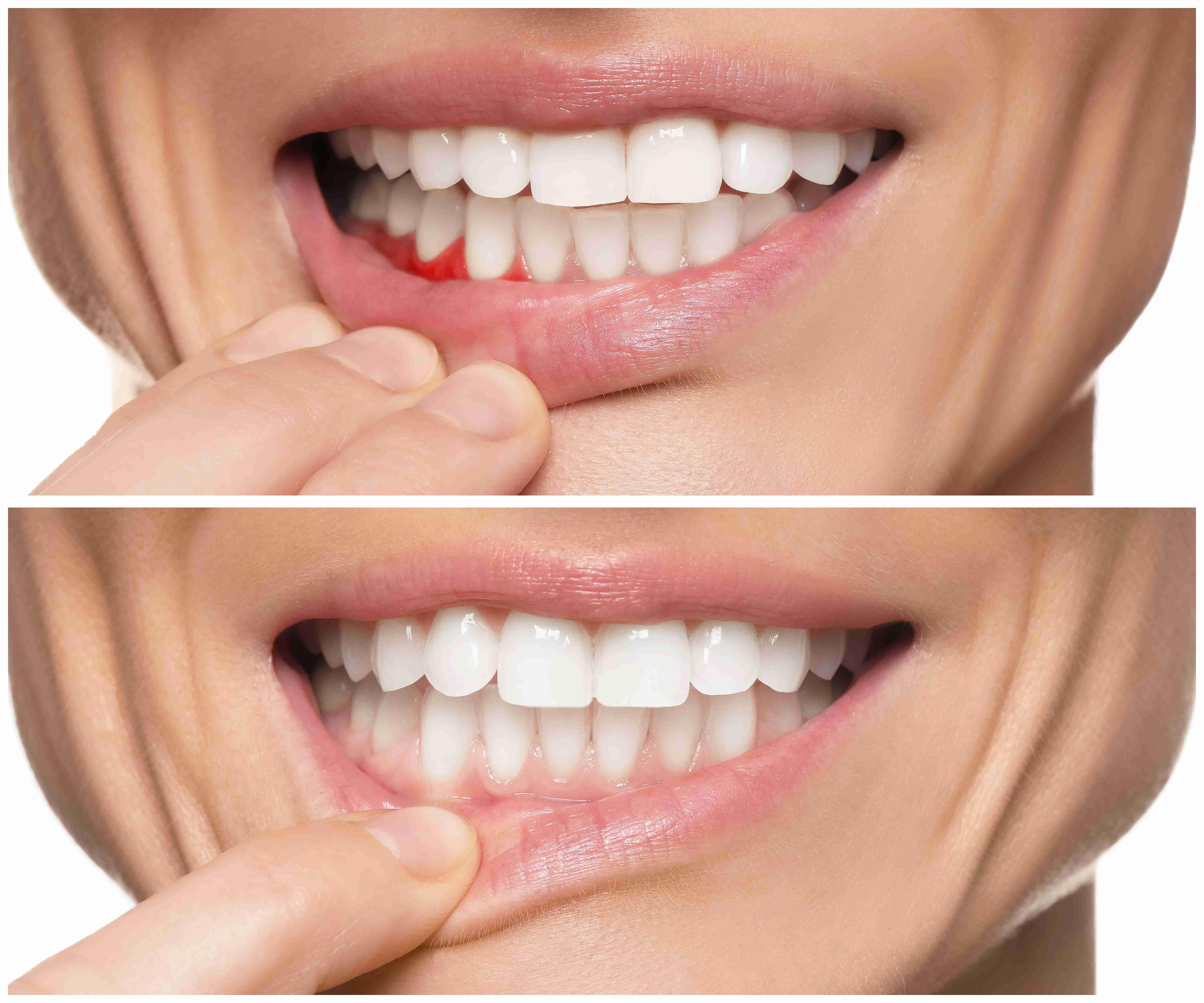 Image Source - Directory Dental Implant