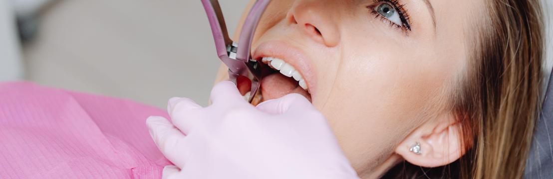 Fixed Price Dental